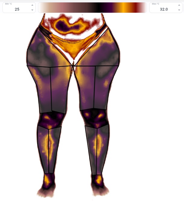 Captura termográfica — detalhe da região inguinal