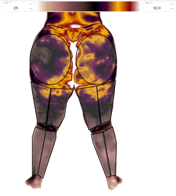 Captura termográfica — vista posterior de glúteos e coxas